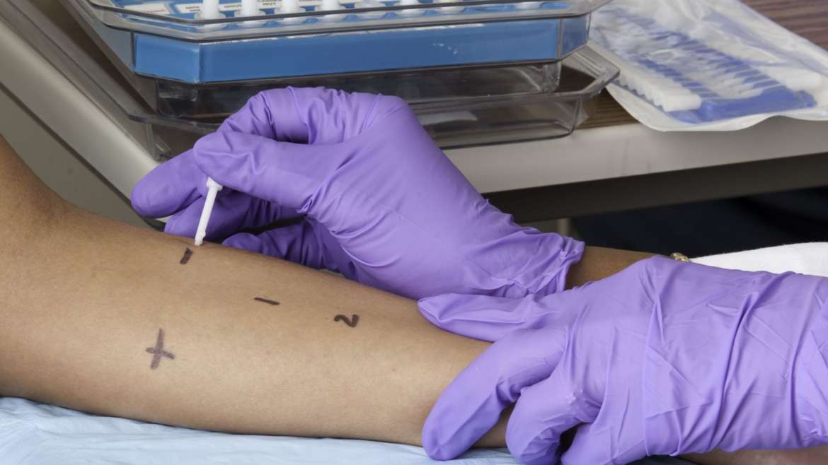Testing For Immunoligical Reactions | El Paso Texas Chiropractor